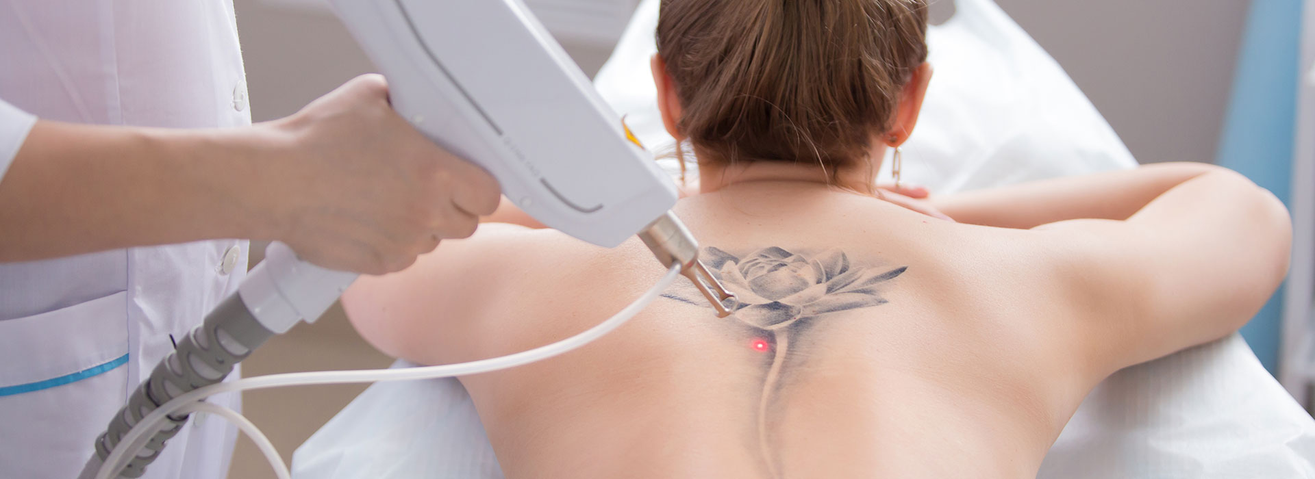 Pico Lazer Tattoo Removal at Trouvaille Med Spa in Bourbonnais, IL