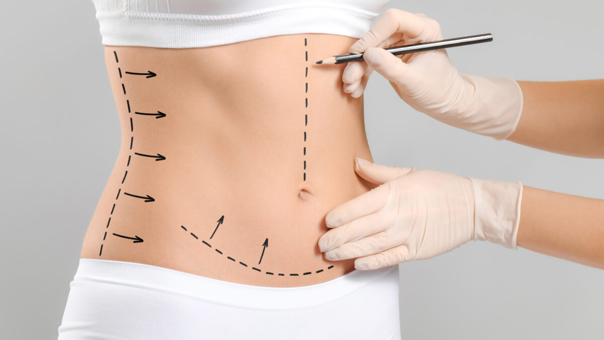 lipo c injection dosage chart female LIPO-C Injection Dosage Guide | PDF | Injection (Medicine) main image 1